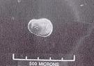 Scanning electron micrographs of non-branching blob.