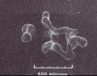 Scanning electron micrographs of branching blob formed in six pore bodies.